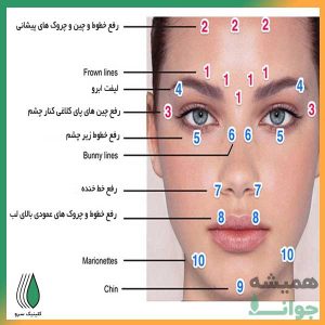 کاربرد تزریق بوتاکس