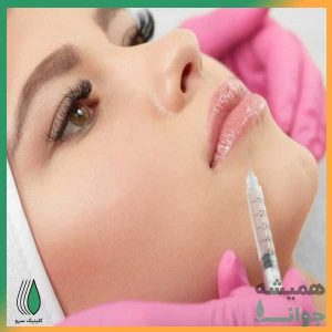 فیلر لب