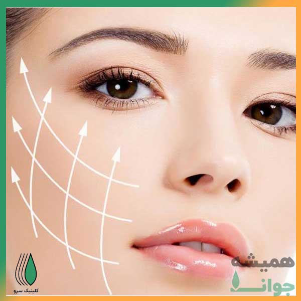 لیفتینگ صورت به روش آر-اف