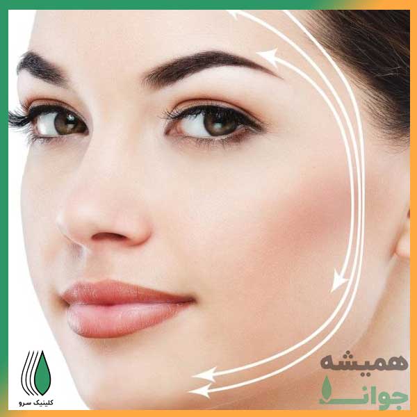 لیفت به روش هایفو