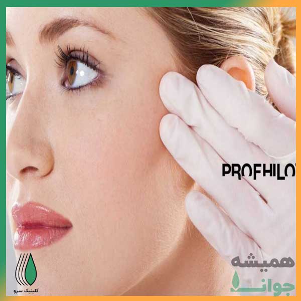 نتیجه پروفایلو